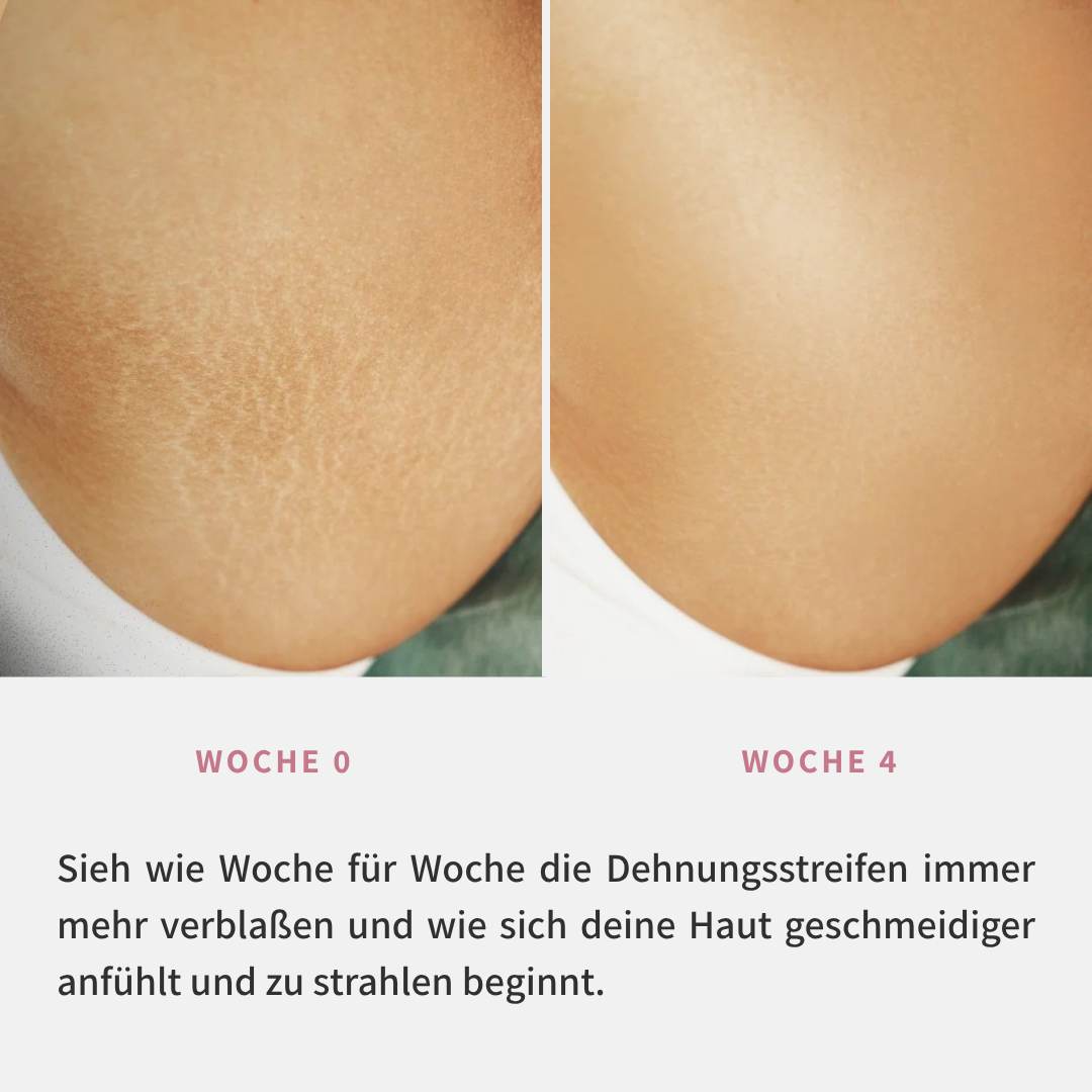SkinPulse™ Pflegeöl